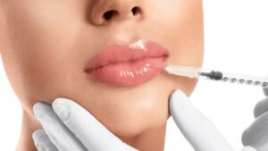 lip filler treatments in Melbourne