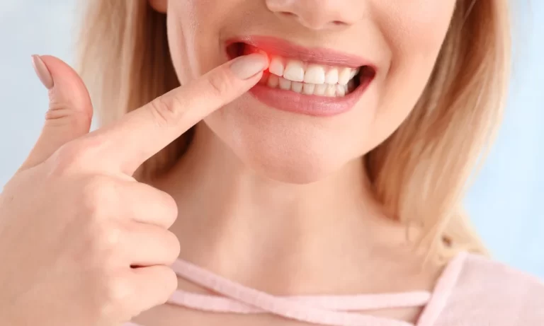 Prevention and Treatment of Gum Infection: Healthy Gums in Simple Steps