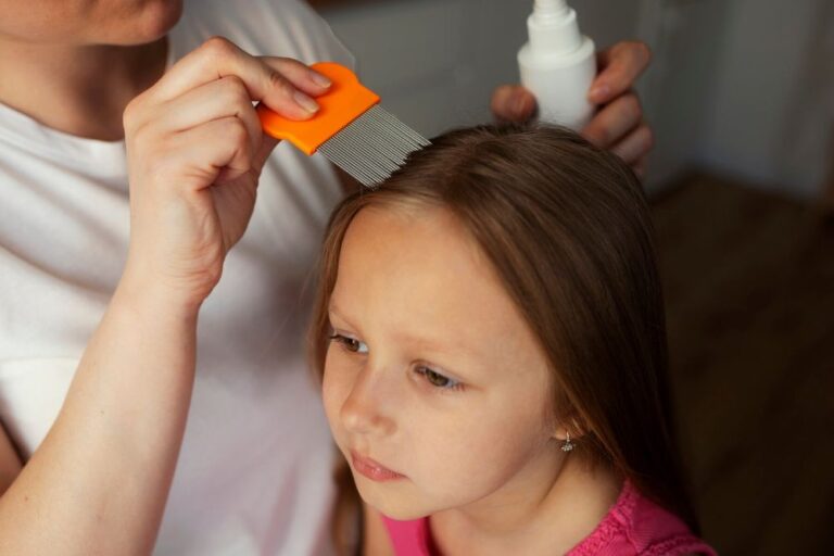 Treating Head Lice: Practical Advice for Healthcare Providers and Parents