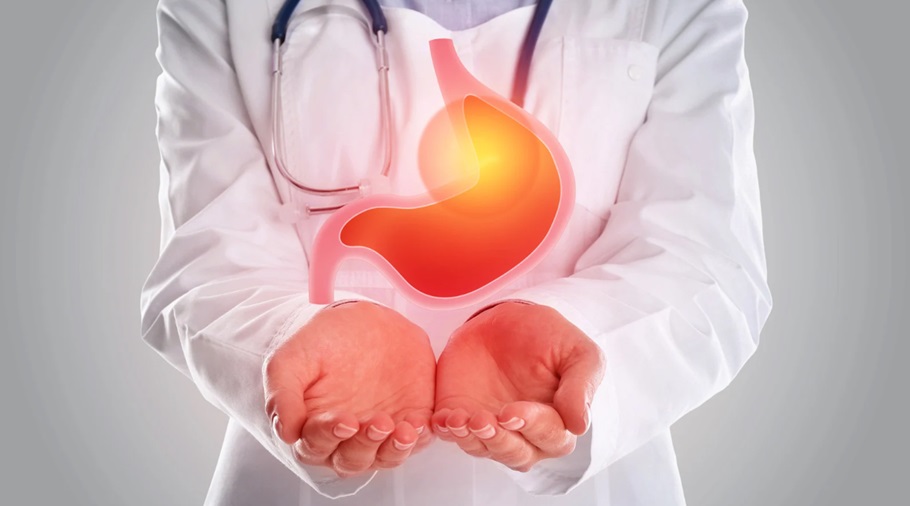 Persistent Acid Reflux